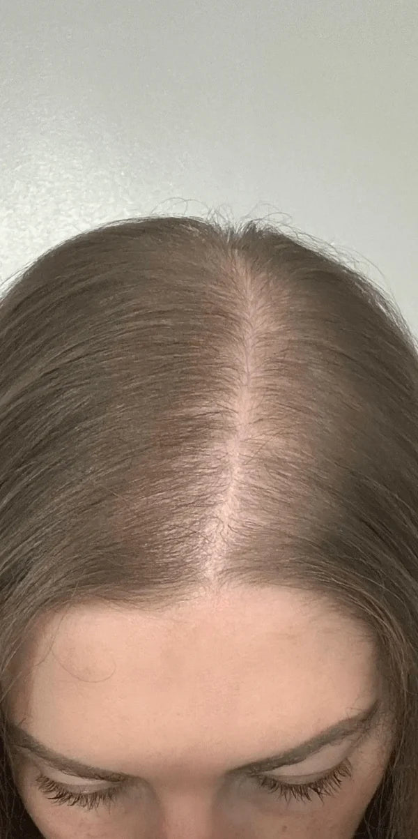 DIA 38
